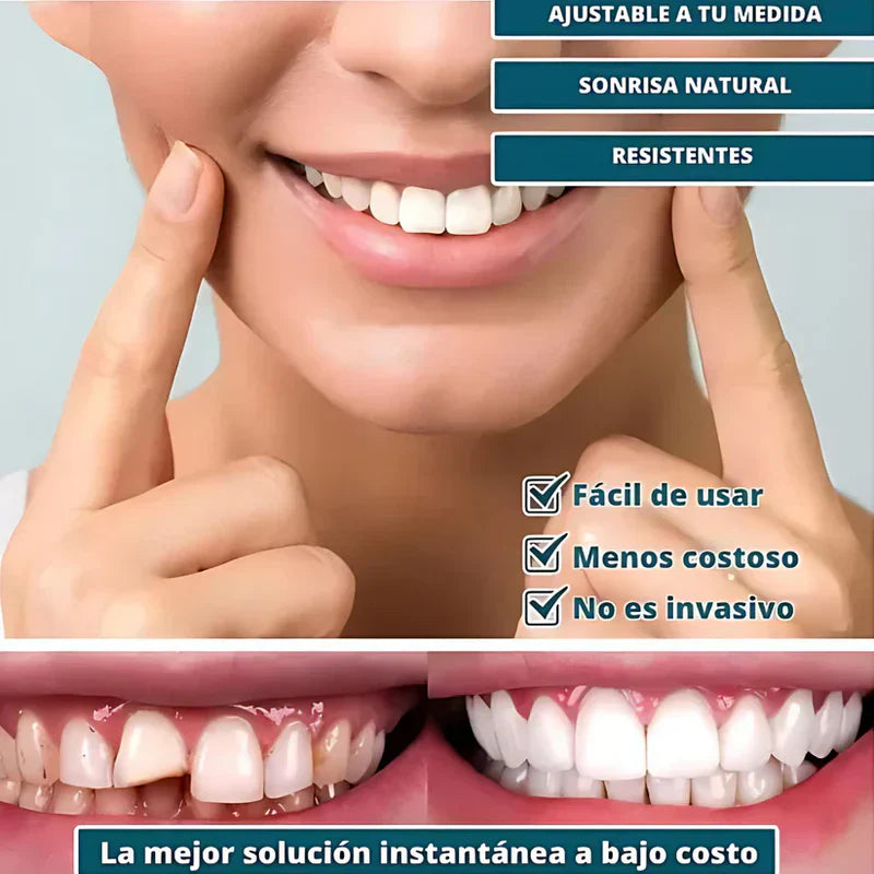 SMILEPRO 🦷 - CARILLAS DENTALES AJUSTABLES DE RESINA + ESTUCHE REGALO - ¡ÚLTIMAS UNIDADES!