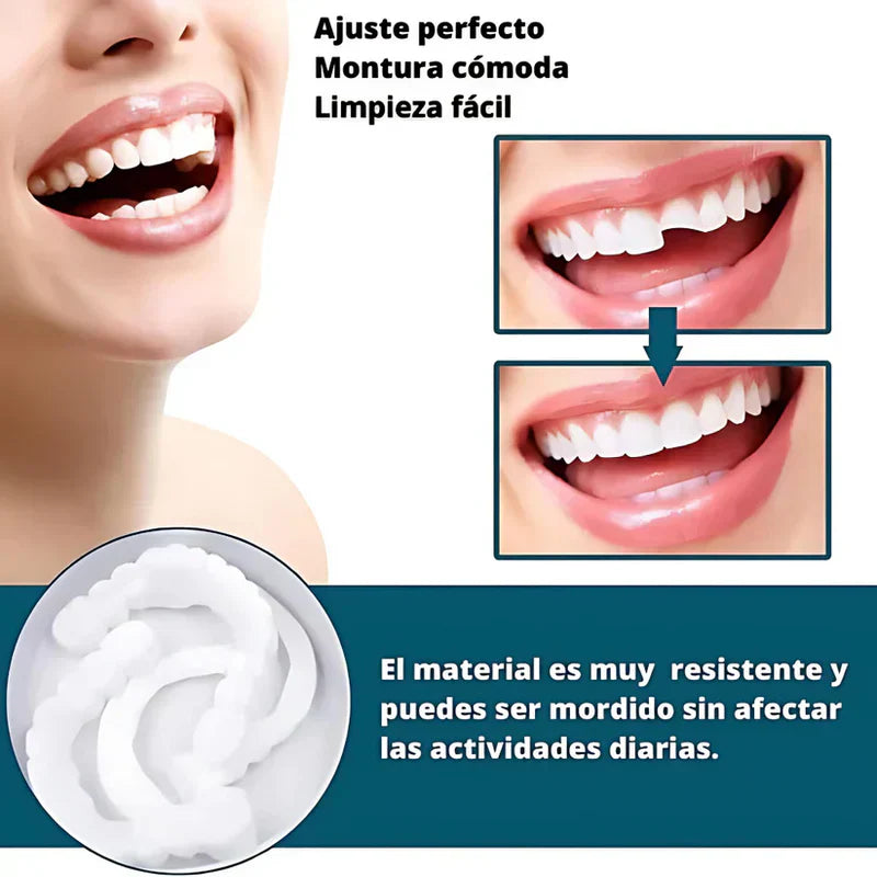 SMILEPRO 🦷 - CARILLAS DENTALES AJUSTABLES DE RESINA + ESTUCHE REGALO - ¡ÚLTIMAS UNIDADES!