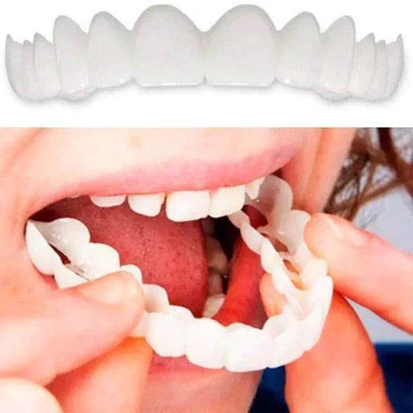 SMILEPRO 🦷 - CARILLAS DENTALES AJUSTABLES DE RESINA + ESTUCHE REGALO - ¡ÚLTIMAS UNIDADES!