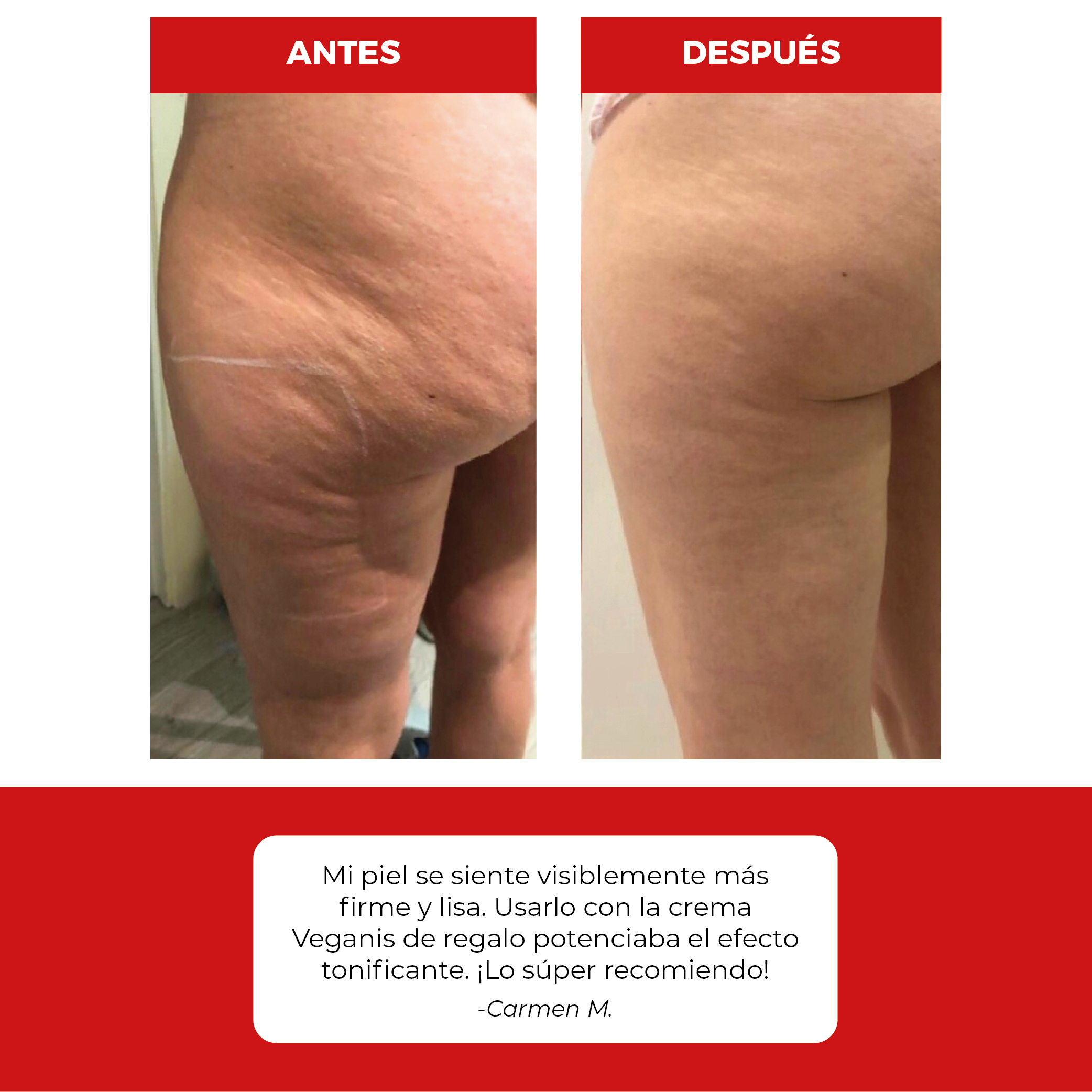 MASAJEADOR 4 EN 1 - TONIFICADOR Y REMOVEDOR DE CELULITIS